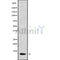 DF9911 at 1/100 staining Mouse colon tissue by IHC-P. The sample was formaldehyde fixed and a heat mediated antigen retrieval step in citrate buffer was performed. The sample was then blocked and incubated with the antibody for 1.5 hours at 22¡ãC. An HRP conjugated goat anti-rabbit antibody was used as the secondary
