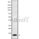 Western blot analysis of CCL17 using LOVO whole cell lysates