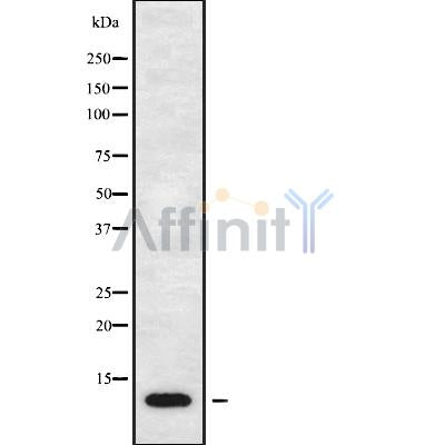 Western blot analysis of CCL17 using LOVO whole cell lysates