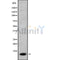 Western blot analysis of CCL26 using COLO205 whole cell lysates