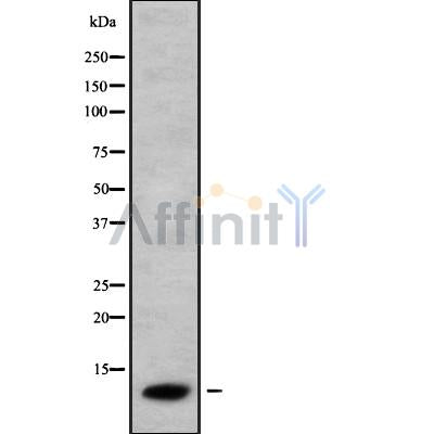 Western blot analysis of CCL26 using COLO205 whole cell lysates