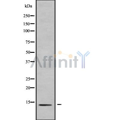 Western blot analysis of CCL27 using Jurkat whole cell lysates
