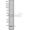 Western blot analysis of CCL27 using Jurkat whole cell lysates