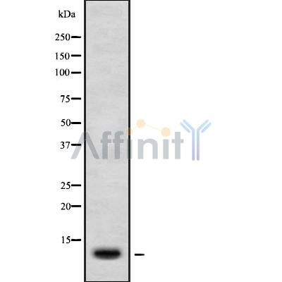 DF9917 at 1/100 staining Human pancreas tissue by IHC-P. The sample was formaldehyde fixed and a heat mediated antigen retrieval step in citrate buffer was performed. The sample was then blocked and incubated with the antibody for 1.5 hours at 22¡ãC. An HRP conjugated goat anti-rabbit antibody was used as the secondary
