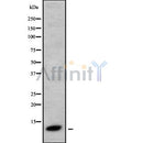 Western blot analysis of CXCL9 using Jurkat whole cell lysates