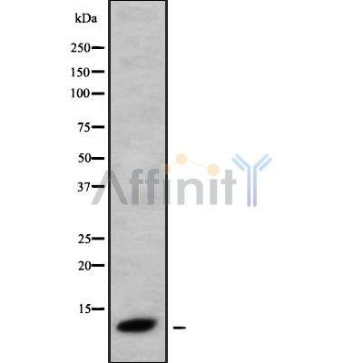 Western blot analysis of CXCL9 using Jurkat whole cell lysates