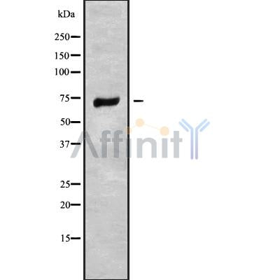 Western blot analysis SLC6A14 using HepG2 whole cell lysates