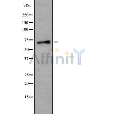 Western blot analysis SLC6A18 using HepG2 whole cell lysates