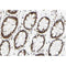 AF0200 at 1/100 staining human colon carcinoma tissue sections by IHC-P. The tissue was formaldehyde fixed and a heat mediated antigen retrieval step in citrate buffer was performed. The tissue was then blocked and incubated with the antibody for 1.5 hours at 22¡ãC. An HRP conjugated goat anti-rabbit antibody was used as the secondary