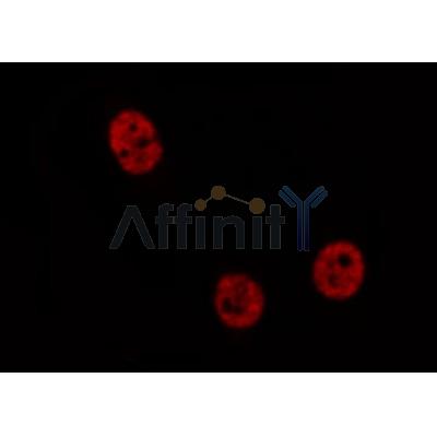 AF0200 staining HeLa  cells by IF/ICC. The sample were fixed with PFA and permeabilized in 0.1% Triton X-100,then blocked in 10% serum for 45 minutes at 25¡ãC. The primary antibody was diluted at 1/200 and incubated with the sample for 1 hour at 37¡ãC. An  Alexa Fluor 594 conjugated goat anti-rabbit IgG (H+L) antibody(Cat.
