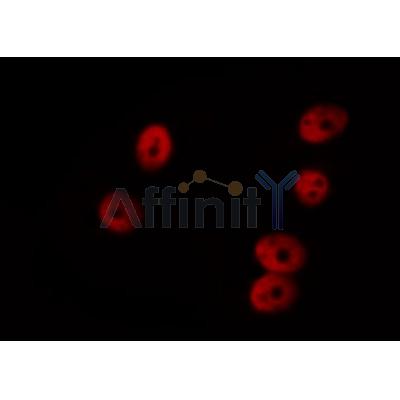 AF0200 staining COS7 by IF/ICC. The sample were fixed with PFA and permeabilized in 0.1% Triton X-100,then blocked in 10% serum for 45 minutes at 25¡ãC. The primary antibody was diluted at 1/200 and incubated with the sample for 1 hour at 37¡ãC. An  Alexa Fluor 594 conjugated goat anti-rabbit IgG (H+L) Ab, diluted at 1/600, was used as the secondary antibod