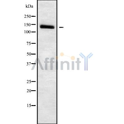 DF9927 at 1/100 staining Human liver cancer tissue by IHC-P. The sample was formaldehyde fixed and a heat mediated antigen retrieval step in citrate buffer was performed. The sample was then blocked and incubated with the antibody for 1.5 hours at 22¡ãC. An HRP conjugated goat anti-rabbit antibody was used as the secondary