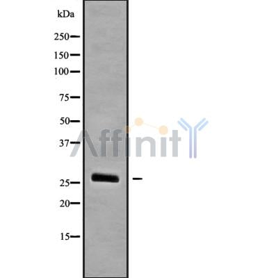 DF9928 at 1/100 staining Rat kidney tissue by IHC-P. The sample was formaldehyde fixed and a heat mediated antigen retrieval step in citrate buffer was performed. The sample was then blocked and incubated with the antibody for 1.5 hours at 22¡ãC. An HRP conjugated goat anti-rabbit antibody was used as the secondary