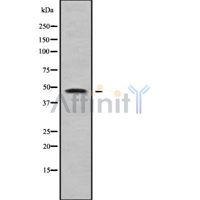 DF9931 at 1/100 staining Human liver cancer tissue by IHC-P. The sample was formaldehyde fixed and a heat mediated antigen retrieval step in citrate buffer was performed. The sample was then blocked and incubated with the antibody for 1.5 hours at 22¡ãC. An HRP conjugated goat anti-rabbit antibody was used as the secondary