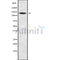 Western blot analysis SLC9A11 using COS7 whole cell lysates