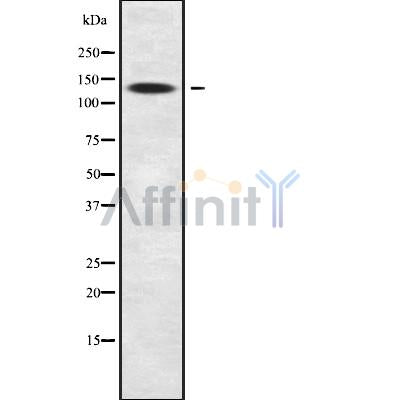 Western blot analysis SLC9A11 using COS7 whole cell lysates