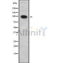 Western blot analysis SLC9A2 using COLO205 whole cell lysates