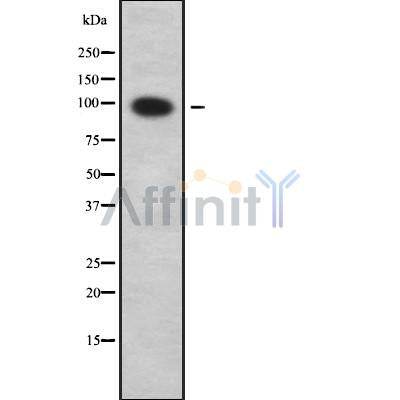 Western blot analysis SLC9A2 using COLO205 whole cell lysates