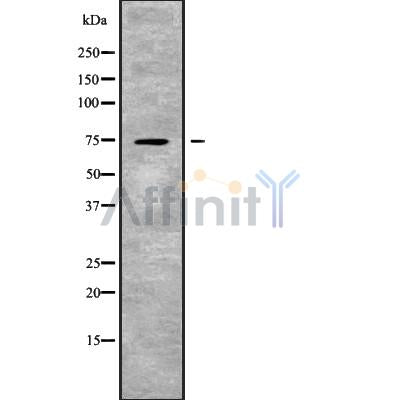 Western blot analysis SLC24A2 using COLO205 whole cell lysates