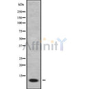 Western blot analysis FXYD2 using COLO205 whole cell lysates
