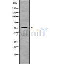 Western blot analysis SLC2A2 using Jurkat whole cell lysates