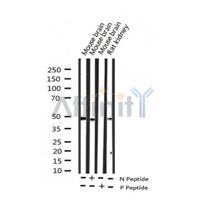 AF3160 staining LOVO by IF/ICC. The sample were fixed with PFA and permeabilized in 0.1% Triton X-100,then blocked in 10% serum for 45 minutes at 25¡ãC. The primary antibody was diluted at 1/200 and incubated with the sample for 1 hour at 37¡ãC. An  Alexa Fluor 594 conjugated goat anti-rabbit IgG (H+L) Ab, diluted at 1/600, was used as the secondary antibod