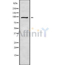 Western blot analysis of extracts from rat spleen and HepG2, using SFRS18 Antibody.