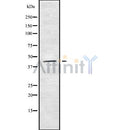 Western blot analysis of extracts from VERO, using SYT8 Antibody. The lane on the left was treated with blocking peptide.

Observed bands: 37 kDa.