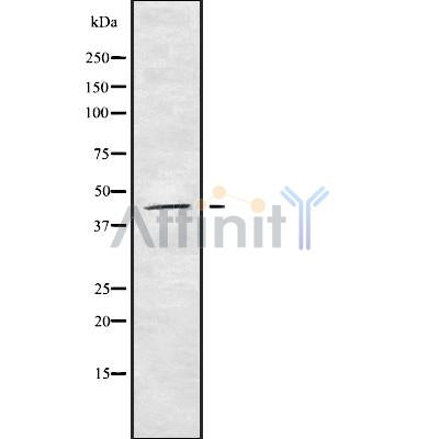 Western blot analysis of extracts from VERO, using SYT8 Antibody. The lane on the left was treated with blocking peptide.

Observed bands: 37 kDa.