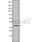 DF9956 at 1/100 staining Mouse kidney tissue by IHC-P. The sample was formaldehyde fixed and a heat mediated antigen retrieval step in citrate buffer was performed. The sample was then blocked and incubated with the antibody for 1.5 hours at 22¡ãC. An HRP conjugated goat anti-rabbit antibody was used as the secondary