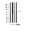 AF3161 staining 293 by IF/ICC. The sample were fixed with PFA and permeabilized in 0.1% Triton X-100,then blocked in 10% serum for 45 minutes at 25¡ãC. The primary antibody was diluted at 1/200 and incubated with the sample for 1 hour at 37¡ãC. An  Alexa Fluor 594 conjugated goat anti-rabbit IgG (H+L) Ab, diluted at 1/600, was used as the secondary antibod