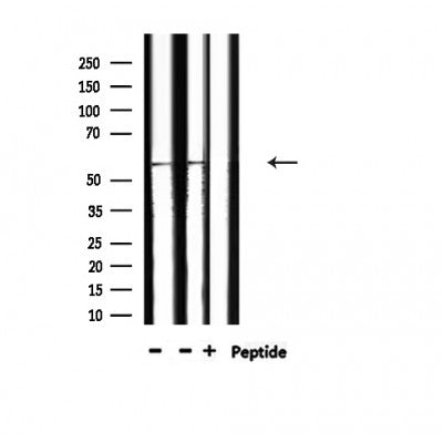 AF3161 staining 293 by IF/ICC. The sample were fixed with PFA and permeabilized in 0.1% Triton X-100,then blocked in 10% serum for 45 minutes at 25¡ãC. The primary antibody was diluted at 1/200 and incubated with the sample for 1 hour at 37¡ãC. An  Alexa Fluor 594 conjugated goat anti-rabbit IgG (H+L) Ab, diluted at 1/600, was used as the secondary antibod