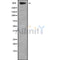 Western blot analysis of TNXB using A549 whole cell lysates