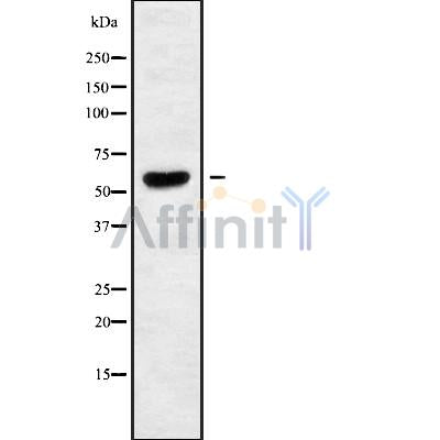 Western blot analysis of extracts from various samples, using TIGD2 Antibody.
 Lane 1: rat brain treated with blocking peptide.
 Lane 2: rat brain;
 Lane 3: 293;
 Lane 4: mouse brain;
 Lane 5: Hela;
 