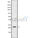 Western blot analysis of TM2D1 using K562 whole cell lysates
