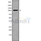 Western blot analysis of TRAK2 using LOVO whole cell lysates