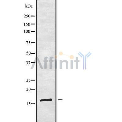Western blot analysis of extracts from mouse brain, using TRAPPC1 Antibody.