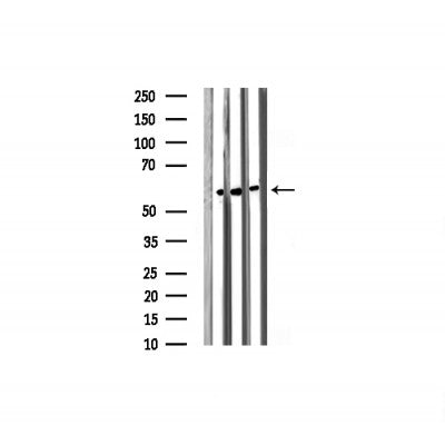 AF3162 staining 293 by IF/ICC. The sample were fixed with PFA and permeabilized in 0.1% Triton X-100,then blocked in 10% serum for 45 minutes at 25¡ãC. The primary antibody was diluted at 1/200 and incubated with the sample for 1 hour at 37¡ãC. An  Alexa Fluor 594 conjugated goat anti-rabbit IgG (H+L) Ab, diluted at 1/600, was used as the secondary antibod