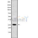 DF9967 at 1/100 staining Mouse lung tissue by IHC-P. The sample was formaldehyde fixed and a heat mediated antigen retrieval step in citrate buffer was performed. The sample was then blocked and incubated with the antibody for 1.5 hours at 22¡ãC. An HRP conjugated goat anti-rabbit antibody was used as the secondary