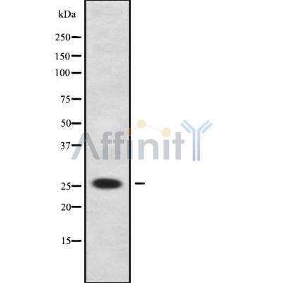 DF9967 at 1/100 staining Mouse lung tissue by IHC-P. The sample was formaldehyde fixed and a heat mediated antigen retrieval step in citrate buffer was performed. The sample was then blocked and incubated with the antibody for 1.5 hours at 22¡ãC. An HRP conjugated goat anti-rabbit antibody was used as the secondary