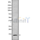 Western blot analysis of TCEAL7 using COLO205 whole cell lysates