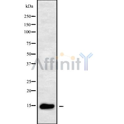 DF9970 at 1/200 staining human kidney tissue sections by IHC-P. The tissue was formaldehyde fixed and a heat mediated antigen retrieval step in citrate buffer was performed. The tissue was then blocked and incubated with the antibody for 1.5 hours at 22¡ãC. An HRP conjugated goat anti-rabbit antibody was used as the secondary