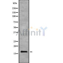 Western blot analysis of BTF3L4 using HT29 whole cell lysates