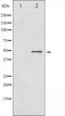 AF3166 at 1/200 staining Rat brain tissue sections by IHC-P. The tissue was formaldehyde fixed and a heat mediated antigen retrieval step in citrate buffer was performed. The tissue was then blocked and incubated with the antibody for 1.5 hours at 22¡ãC. An HRP conjugated goat anti-rabbit antibody was used as the secondary