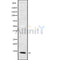 Western blot analysis of MPHOSPH10 using Jurkat whole cell lysates