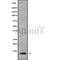 Western blot analysis of LSM2 using Jurkat whole cell lysates