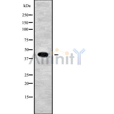 Western blot analysis USP12 using K562 whole cell lysates