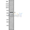 Western blot analysis USP14 using Jurkat whole cell lysates