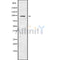 DF9983 staining HepG2 by IF/ICC. The sample were fixed with PFA and permeabilized in 0.1% Triton X-100,then blocked in 10% serum for 45 minutes at 25¡ãC. The primary antibody was diluted at 1/200 and incubated with the sample for 1 hour at 37¡ãC. An  Alexa Fluor 594 conjugated goat anti-rabbit IgG (H+L) Ab, diluted at 1/600, was used as the secondary antibod