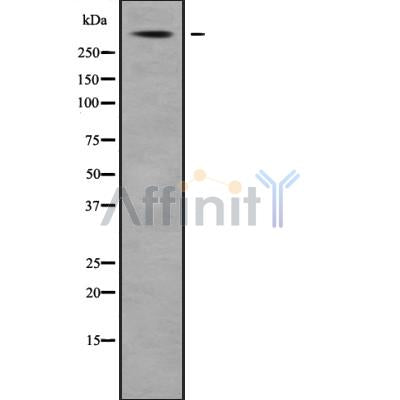 Western blot analysis USP24 using Jurkat whole cell lysates